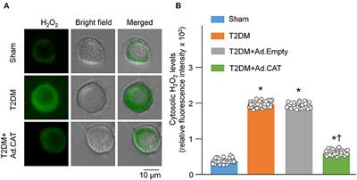 Hydrogen Peroxide Scavenging Restores N-Type Calcium Channels in Cardiac Vagal Postganglionic Neurons and Mitigates Myocardial Infarction-Evoked Ventricular Arrhythmias in Type 2 Diabetes Mellitus